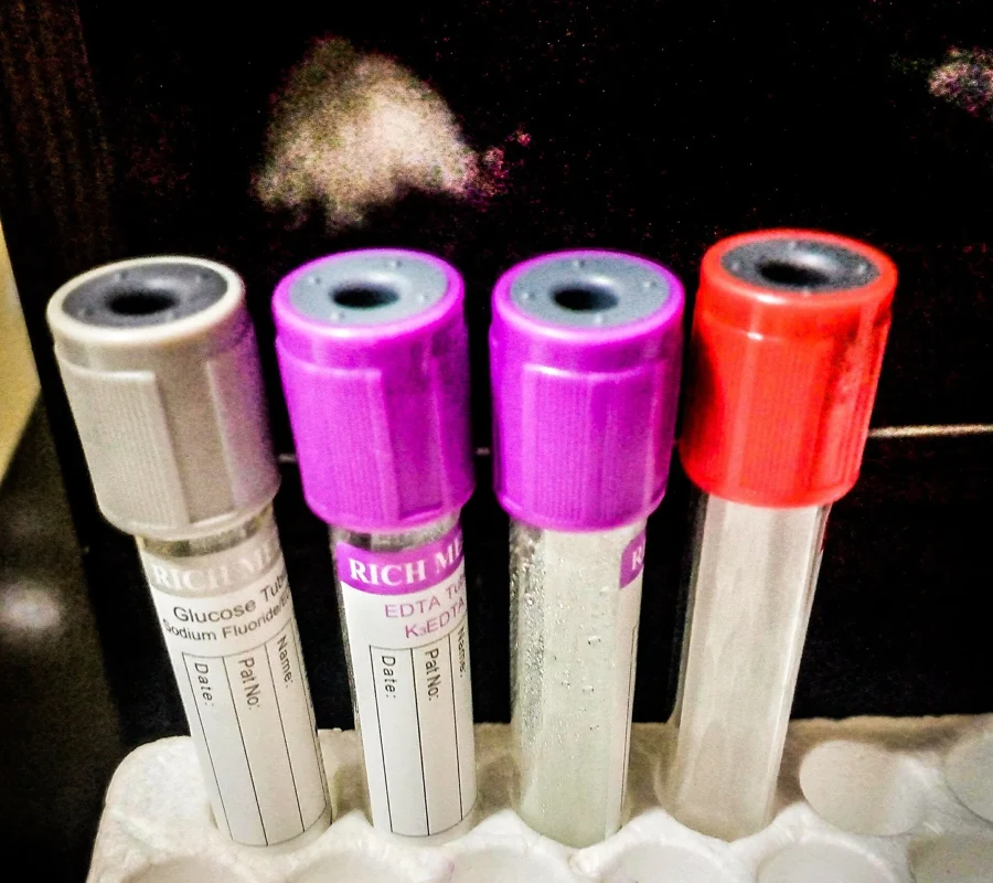 Tubes de prélèvement sanguin à bouchons gris, violets et rouge sur un portoir de laboratoire